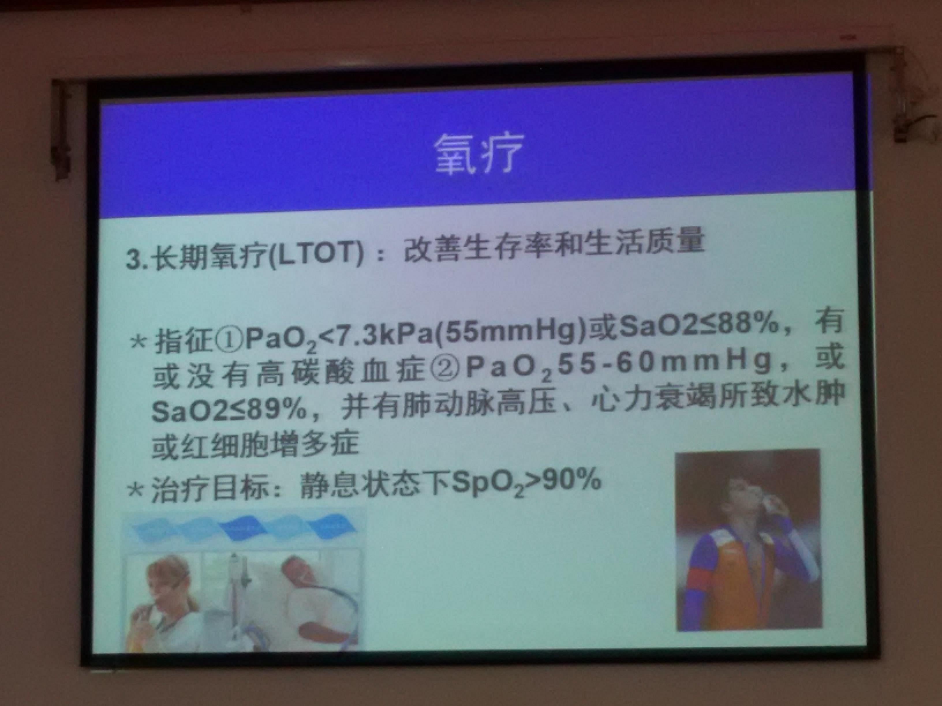 欧格斯氧疗